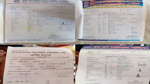 বোরহানউদ্দিনে একই টেস্টে তিন ডায়াগনস্টিক সেন্টারের ভিন্ন রিপোর্ট